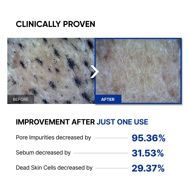 Microbiome Renewing Cream Mask for Pore Care & Glass Skin Effect - Gentle Exfoliating Face Mask, 100ml
