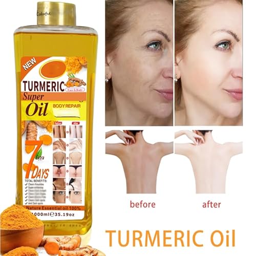 Vitamin C Body Oil, 1000ml Tumeric Body Oil, Retinol Vitamin C 7days, Vit C Body Corrector Oil for Uneven Skin Tone (1000ML VC)
