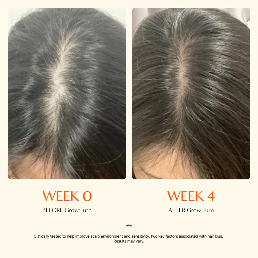 Growturn Hair serum with Built in Brush for Hair Growth & Thickening | Treatment for Thinning Hair, Hair Loss | Low Irritation, Fragrance-Free, Sulfate & Paraben-Free, 3.38 fl. oz. (Pack of 1)
