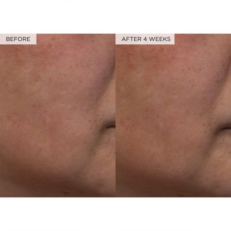 Glow Recipe PHA + BHA Face Toner - Korean Skin Care Toner, Pore Minimizer & Facial Exfoliator for Glass Skin - Tightening & Hydrating Skincare with Hyaluronic Acid & Watermelon (150ml)