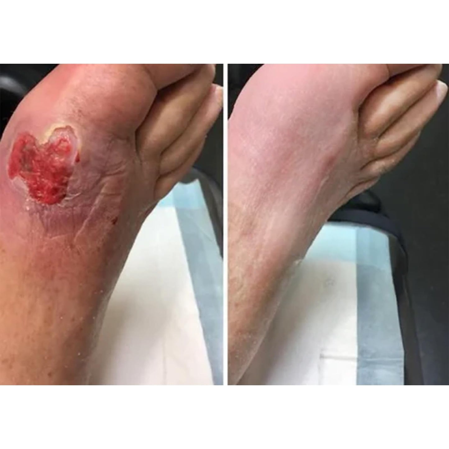 flysmus VitaGluco Diabetes Treatment Cream, Diabetics Skin Relief Cream, Professional Diabetes Treatment cream, Foot Care - Keep Feet Healthy (2)