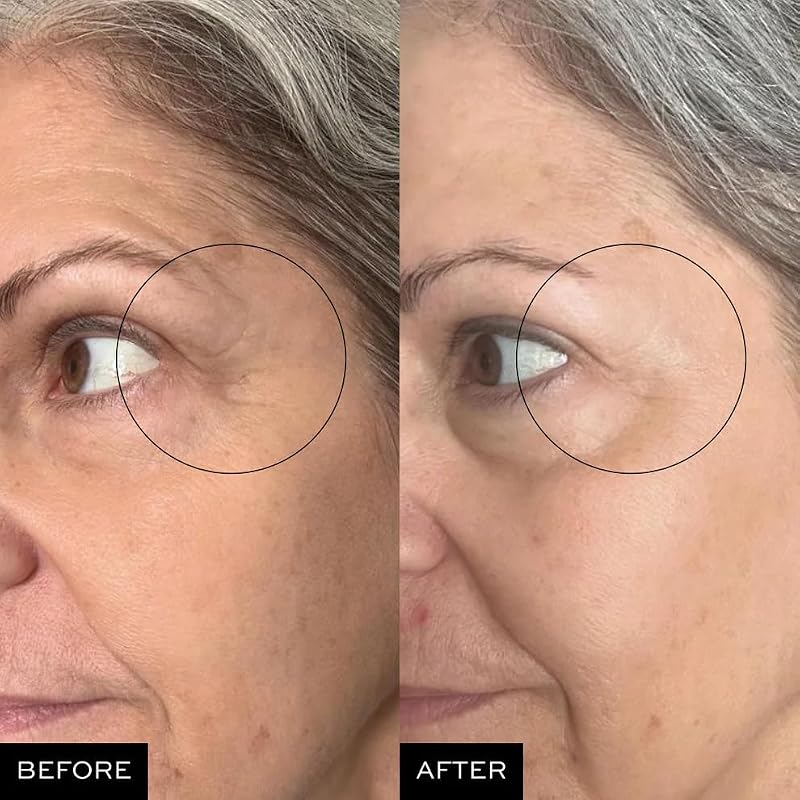 Anti-Aging Face Serum for Fine Lines and Wrinkles - 0.50 oz