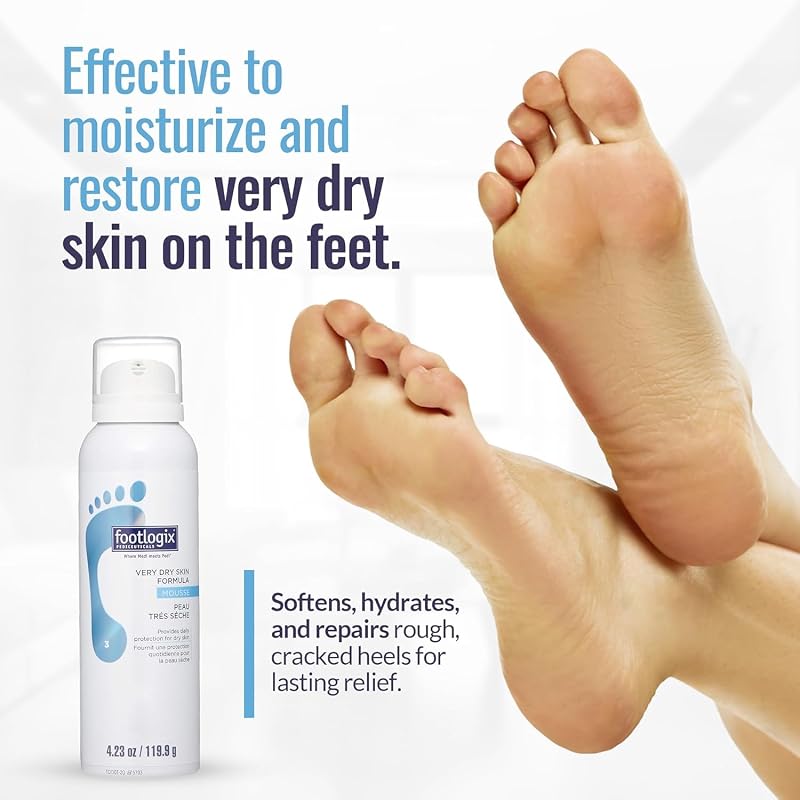 Footlogix Very Dry Skin Mousse for Feet – Urea, Co-Q10, Aloe & Vitamin E 4.23 fl oz