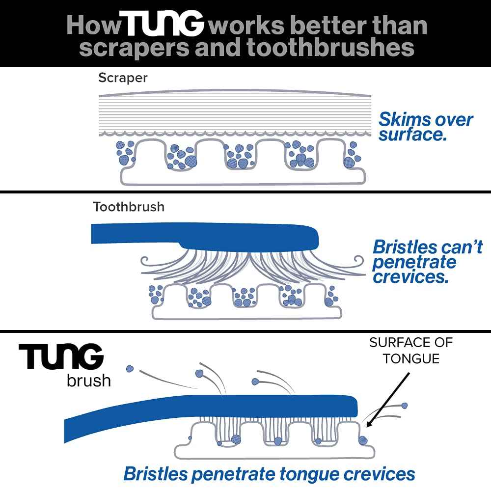 Tung Tongue Cleaning Kit, Tung Brush and Gel, Bad Breath Odor Eliminator, Halitosis Defense, USA Made (Set of 2)