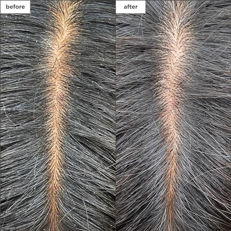 Briogeo Scalp Revival Charcoal + Tea Tree Cooling Hydration Scalp Mask | Weekly Scalp Treatment for Dry, Flaky, or Itchy Scalp | Detoxifying & Moisturizing | Vegan & Cruelty Free | 6 oz