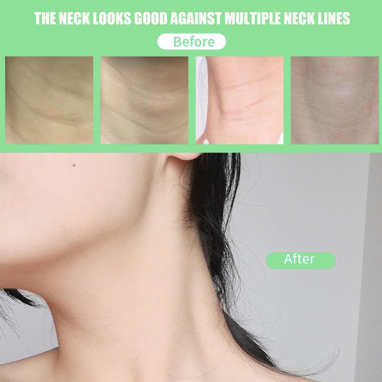 Edskyscraper Neck Tape, 40/120 PCS Neck Tape Lift Turkey Neck, Face Lifting Tape Invisible, For Lifting Loose Sagging Skin, Eye, Cheek, Double Chin, For Women Behind Neck (A(80Patches))