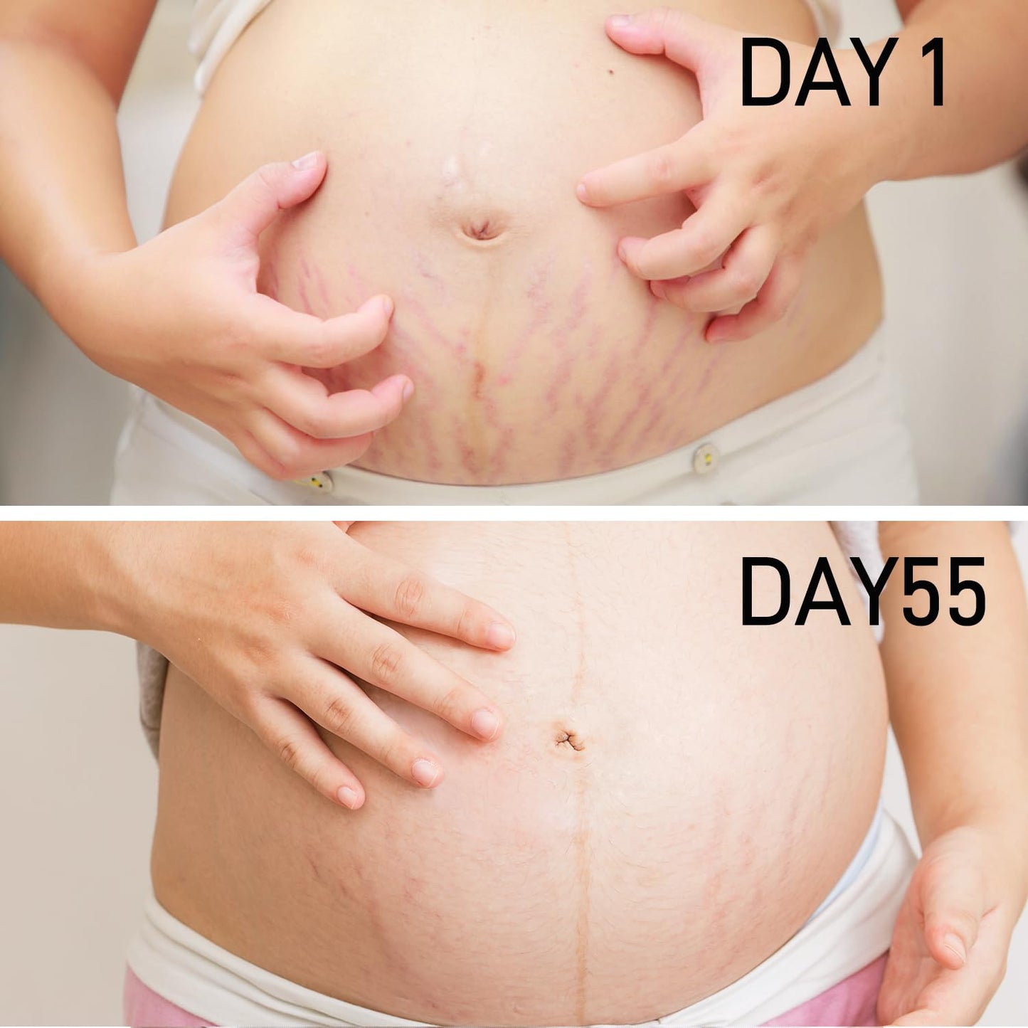 PEGO Stretch Mark Oil for Pregnancy, Maternity Body Oil for Stretch Mark Prevention & Reduction, Hydrating Skin Care, 4.06oz (2Pack)