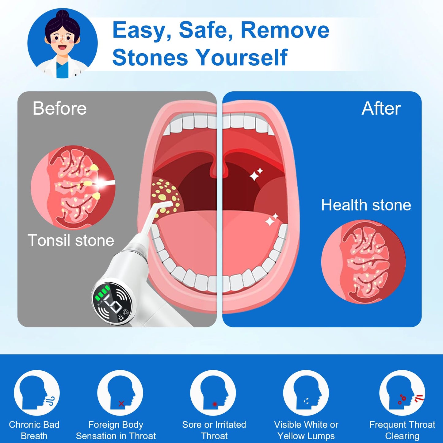 Tonsil Stone Remover Tool, Upgraded Electric Tonsil Stone Removal Kit - with Built-in LED Light & 6-Level Suction for Bad Breath Prevention, Oral Suction Device for Stone Removal
