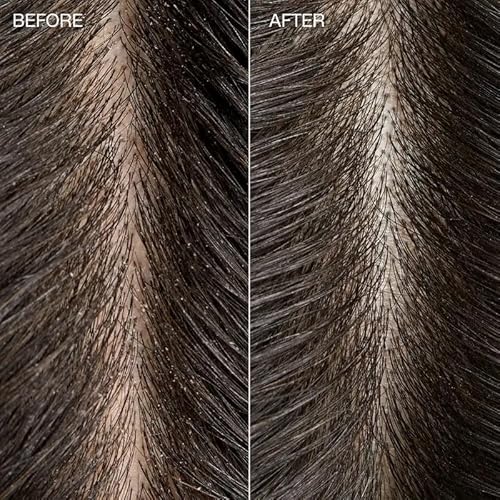 Tea Tree Special Detox Kombucha Rinse, Removes Buildup, Adds Shine, For All Hair Types