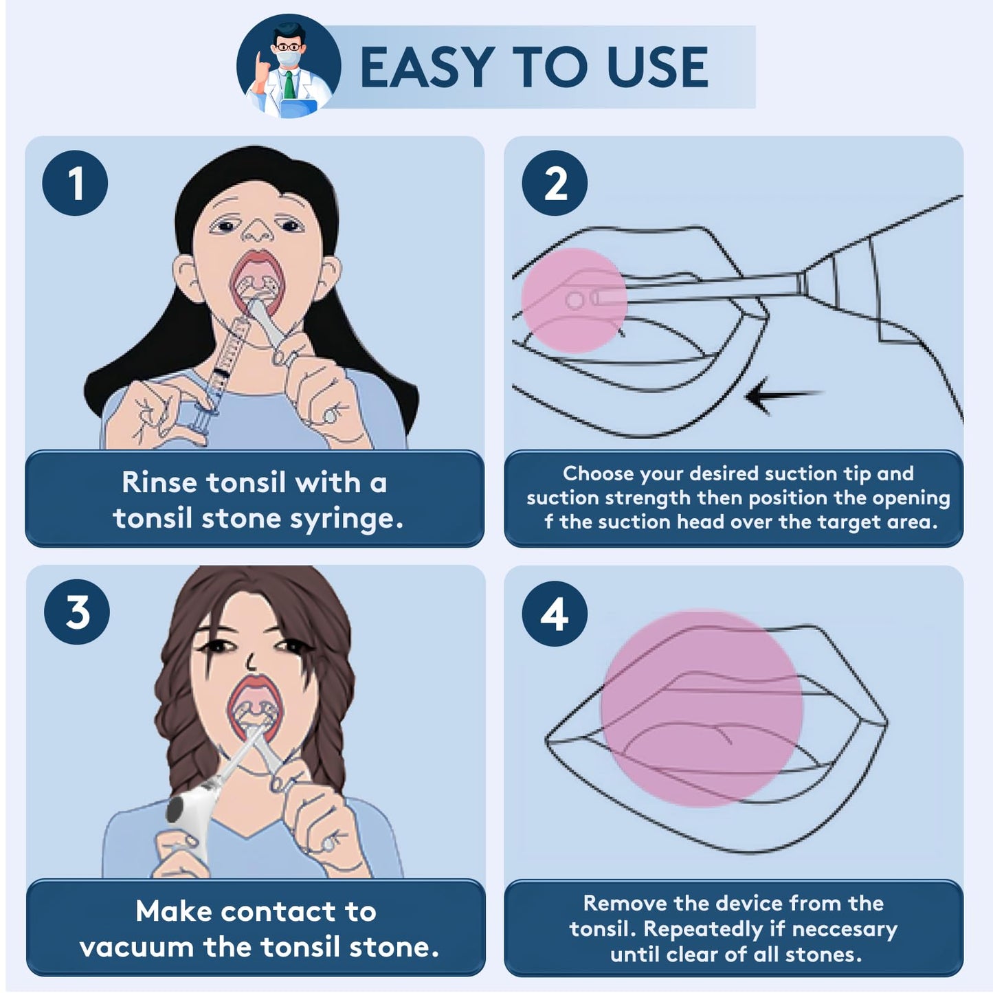 Tonsil Stone Remover Kit - Electronic Tonsil Stone Vacuum with Built-in LED Light - Tonsil Stone Removal Kit with 3 Levels Suction - Instant Suction - Irrigator and 5X Magnifying Mirror (White)