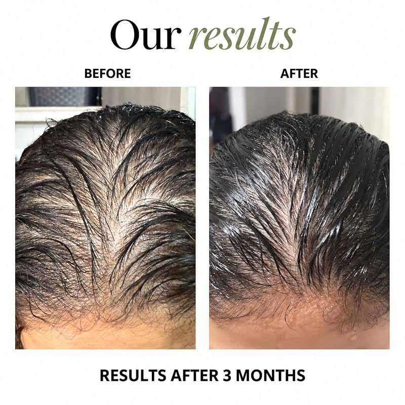 BUNDU Hair Growth Supplements – 90 Soft Capsules for Fuller Hair & Reduced Shedding
