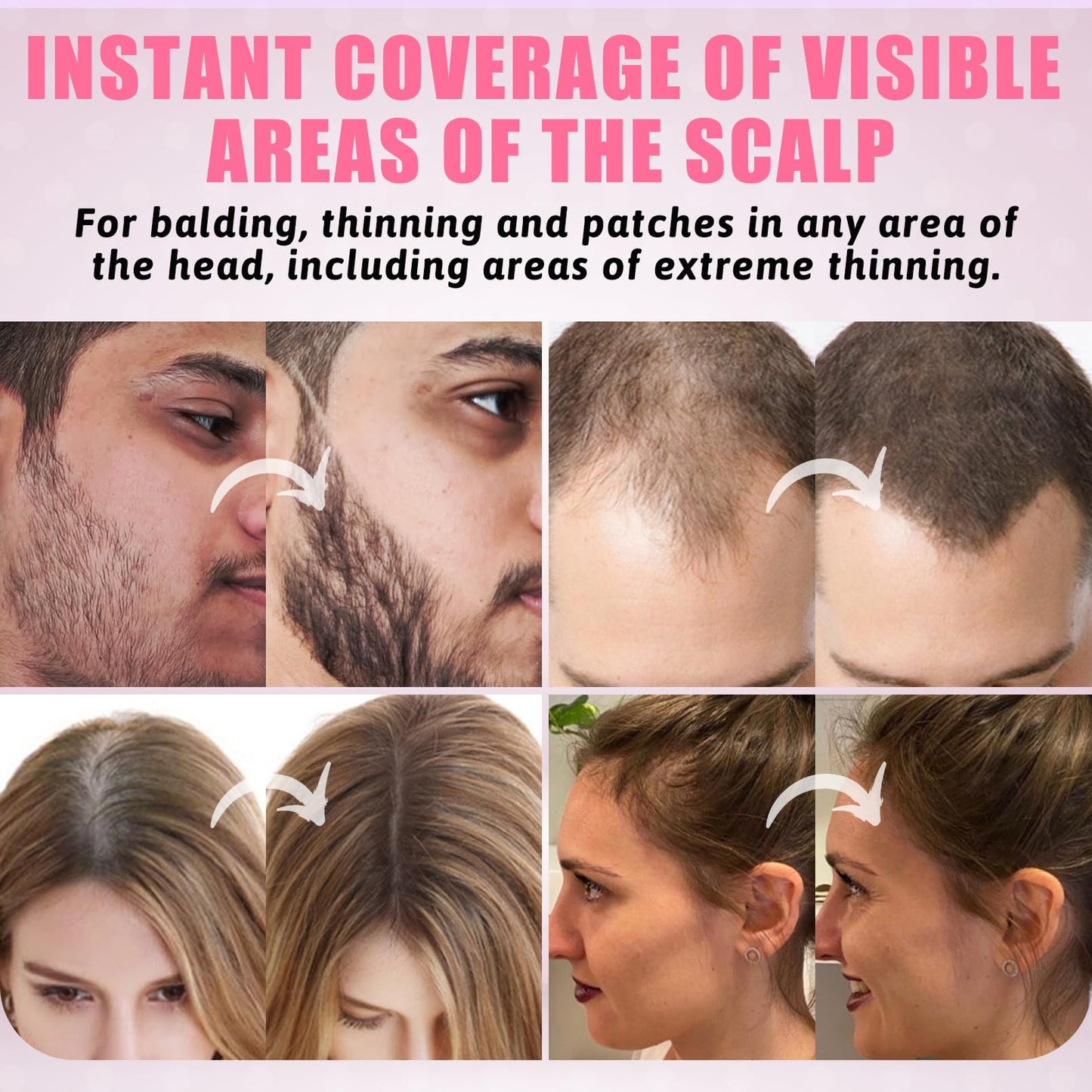 ZENTANMEI Root Touch Up Hairline Powder for Women & Men, Gray Hair Cover Up, Hairline Shadow Powder Sweatproof & Windproof, 0.14 oz Root Cover Up for Thinning Hair (Light Brown)