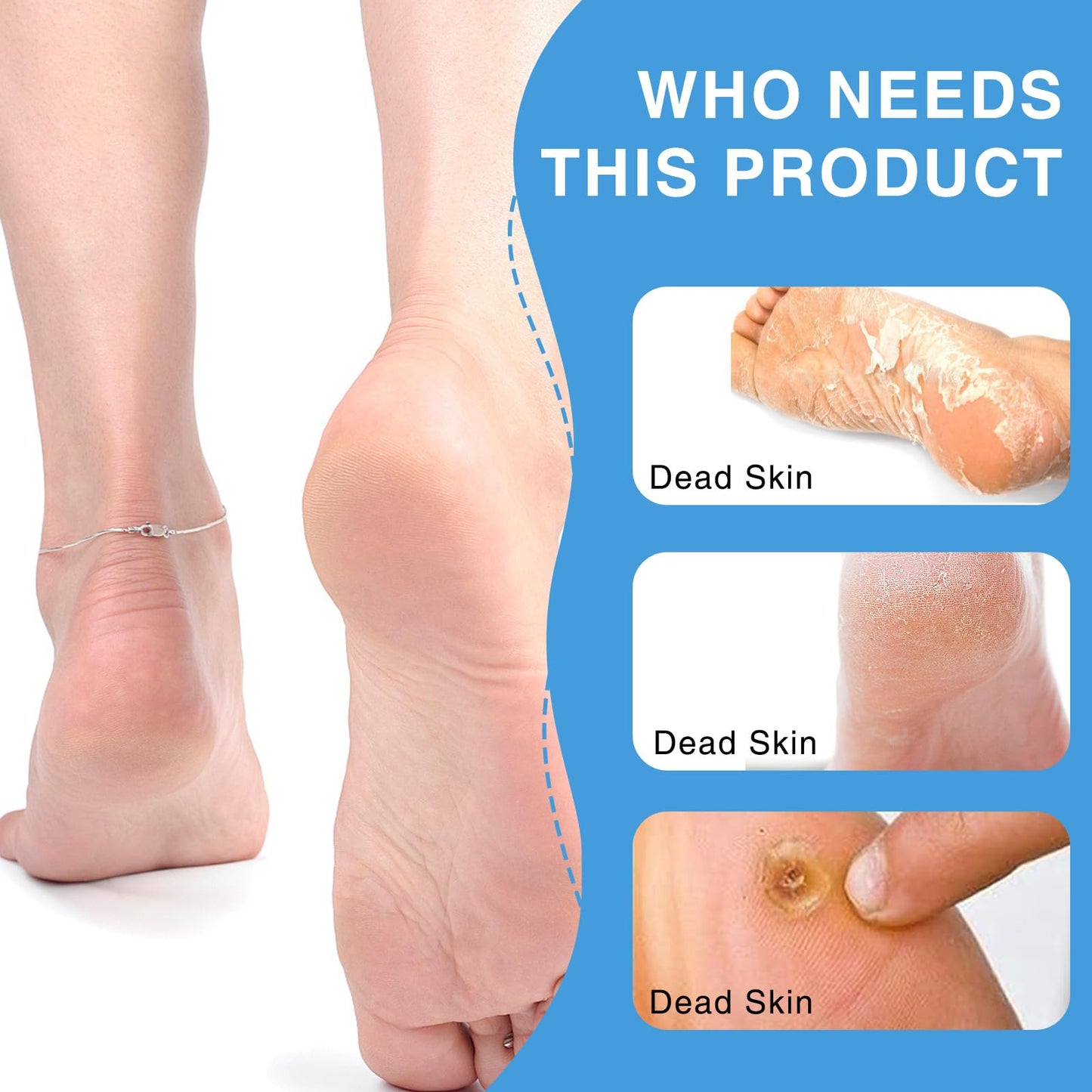 Qiyuda 3 Pcs 4 in 1 Foot Brush, Shower Foot Cleaning Scrubber Pedicure Brush Dead Skin Remover