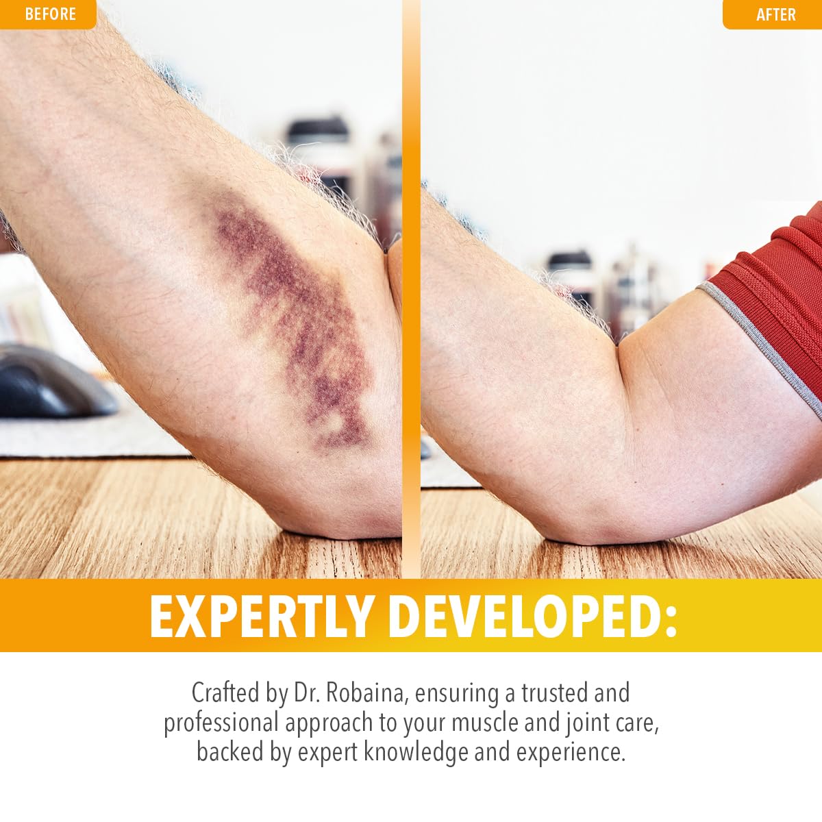 Dr. Robaina Arnica Bruise Cream 4 oz – Concentrated Arnica & Vitamin K Moisturizer for Skin That Looks More Even After Bumps & Cosmetic Touch-Ups – Fast-Absorbing, Non-Greasy, Made in USA