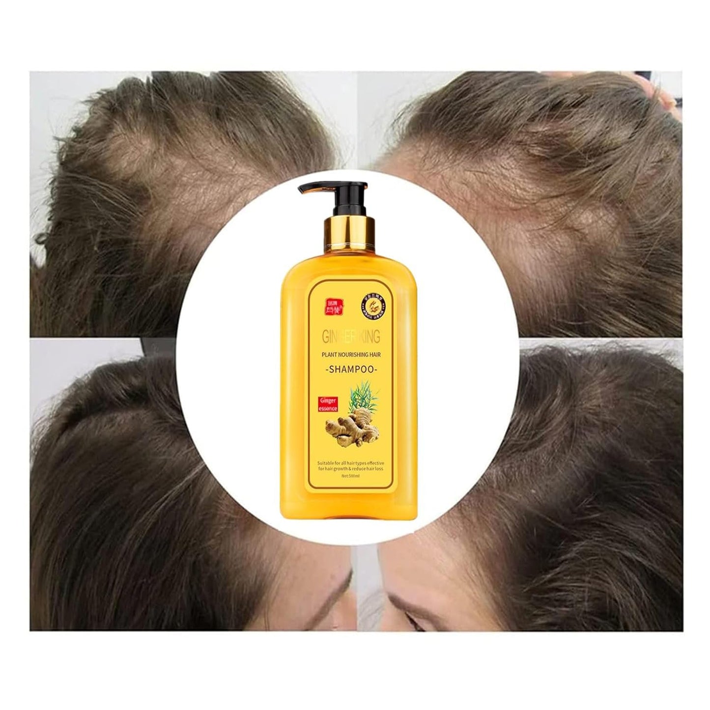Ginaday Instant Ginger Hair Regrowth Shampoo, Ginger Anti-Fall Shampoo for Hair Growth, Anti-Hair Loss Hair Shampoo (1Pcs 16.91FL.oz/500ML)