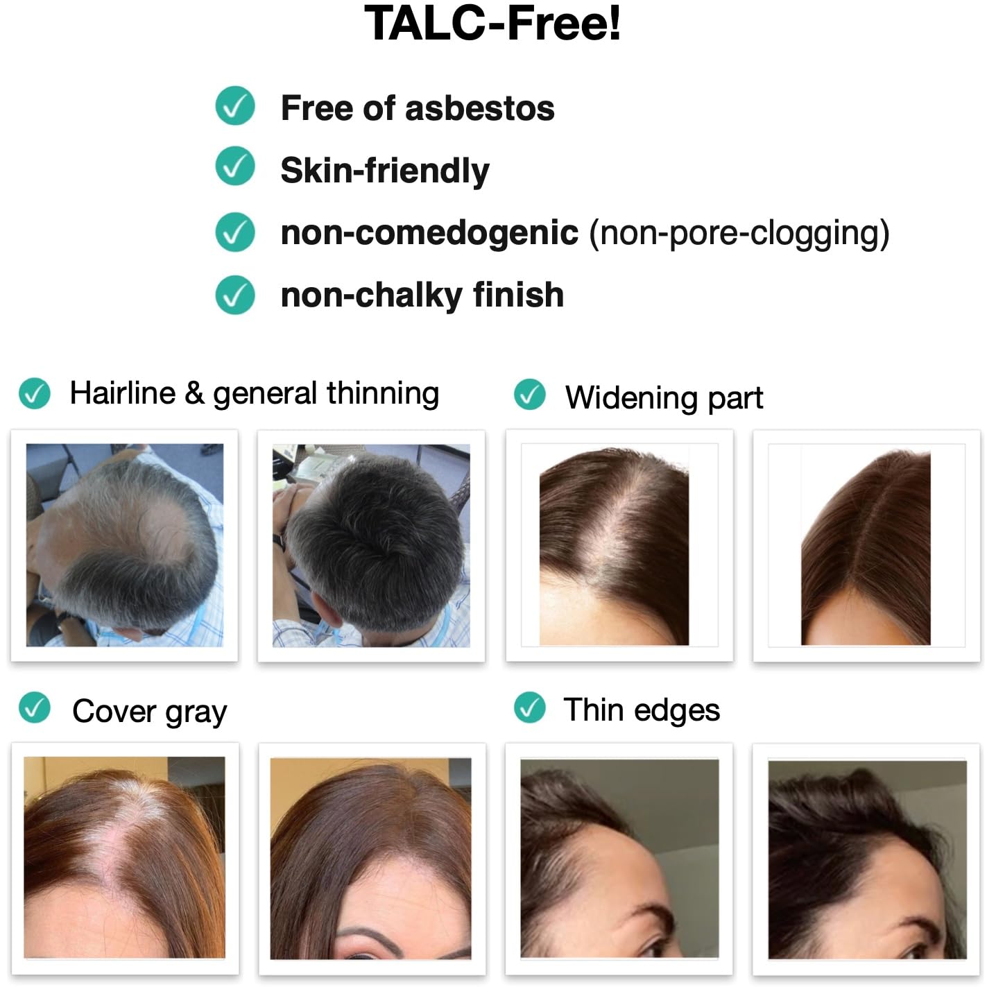 Caboki 10X Volumizing Hair Powder for Thinning Hair: Root Touch Up for Men and Women, Fill in Hairline & Edges, Cover Bald Spots. TALC-Free, Dark Gray