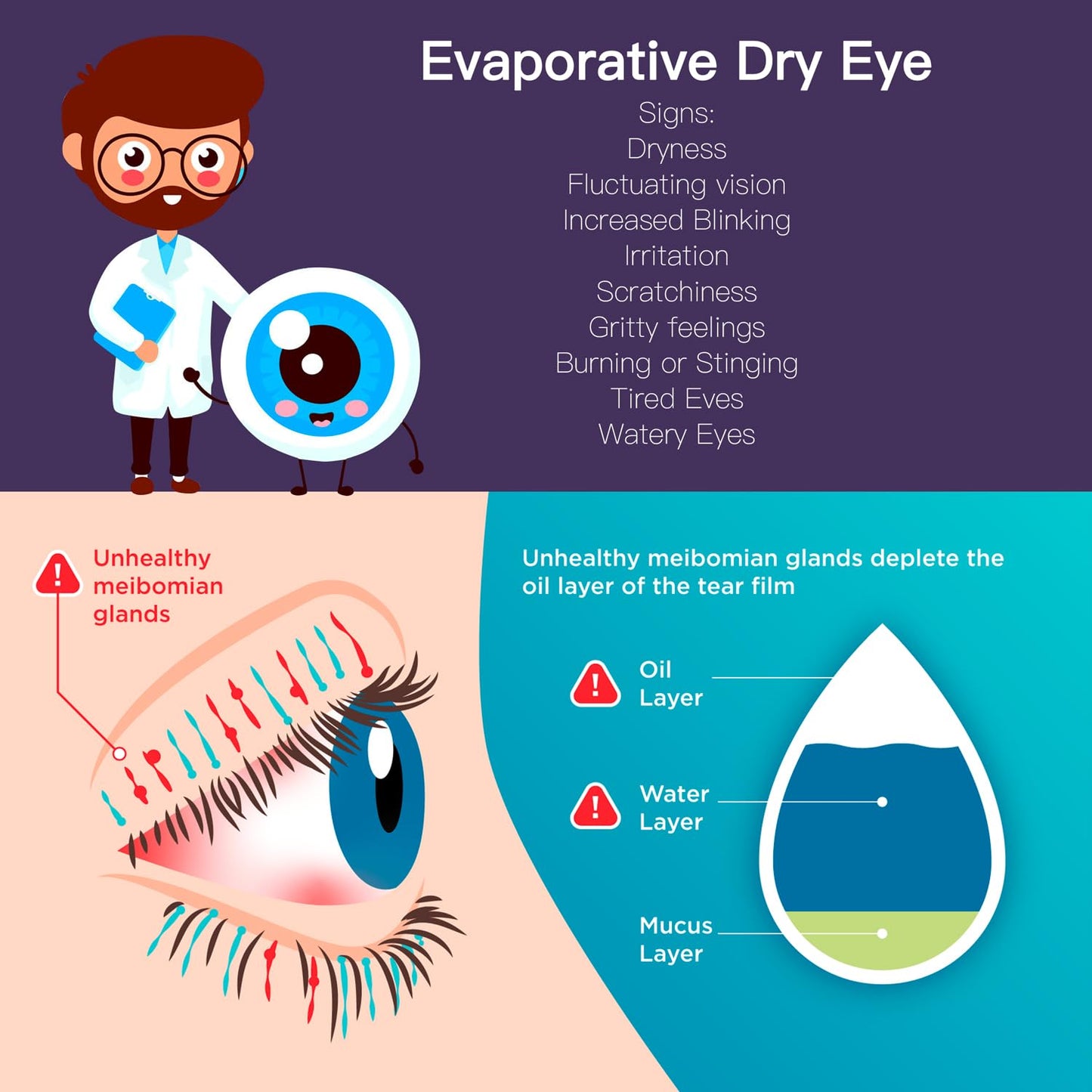 Packve Heated Eye Mask for Dry Eyes with Temperature & Timer Remote, Eye Warm Compress Mask to Unclog Glands Eye Heating Pad for Women Men Relieve Blepharitis, Chalazion, MGD, Stye Syndrome; Purple