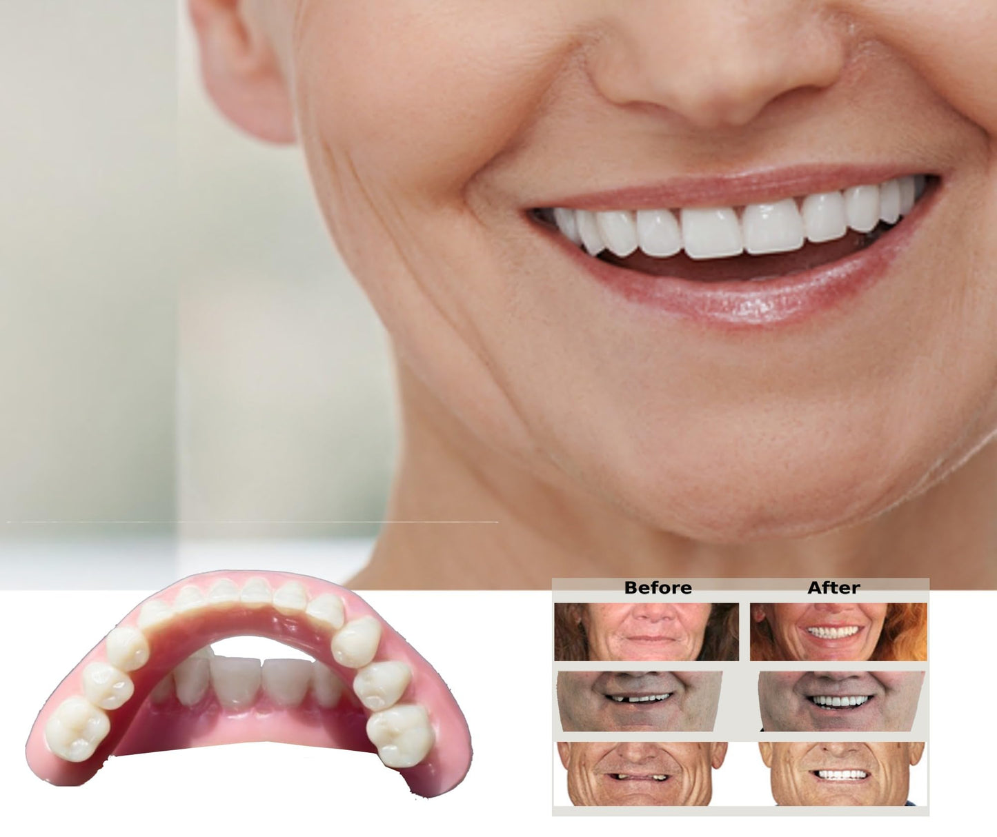 DENTUREWAY DIY Denture Kit with Impression(2 Sets of False Teeth),Do-It-Yourself Denture Solution,DIY Partial Denture kit, DIY Denture (Nature)