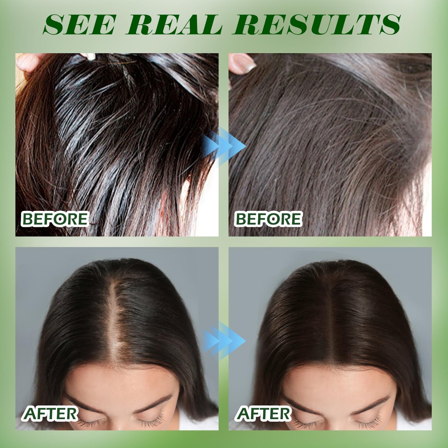 Rosemary Shampoo for Hair Growth with Biotin for Thinning Hair for Women & Men, Rosemary Hair Growth Shampoo with Mint & Tea Tree Oil, Strengthening & Regrowth Formula for Hair Loss 16.9 oz