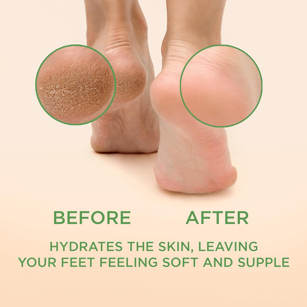 Lee Beauty Professional Callus Remover for Feet - Original, Powerful Formulation - Extra Strength Gel, Home Pedicure Foot Spa Results - Cracked & Dead Dry Skin Supplies - 8 Oz