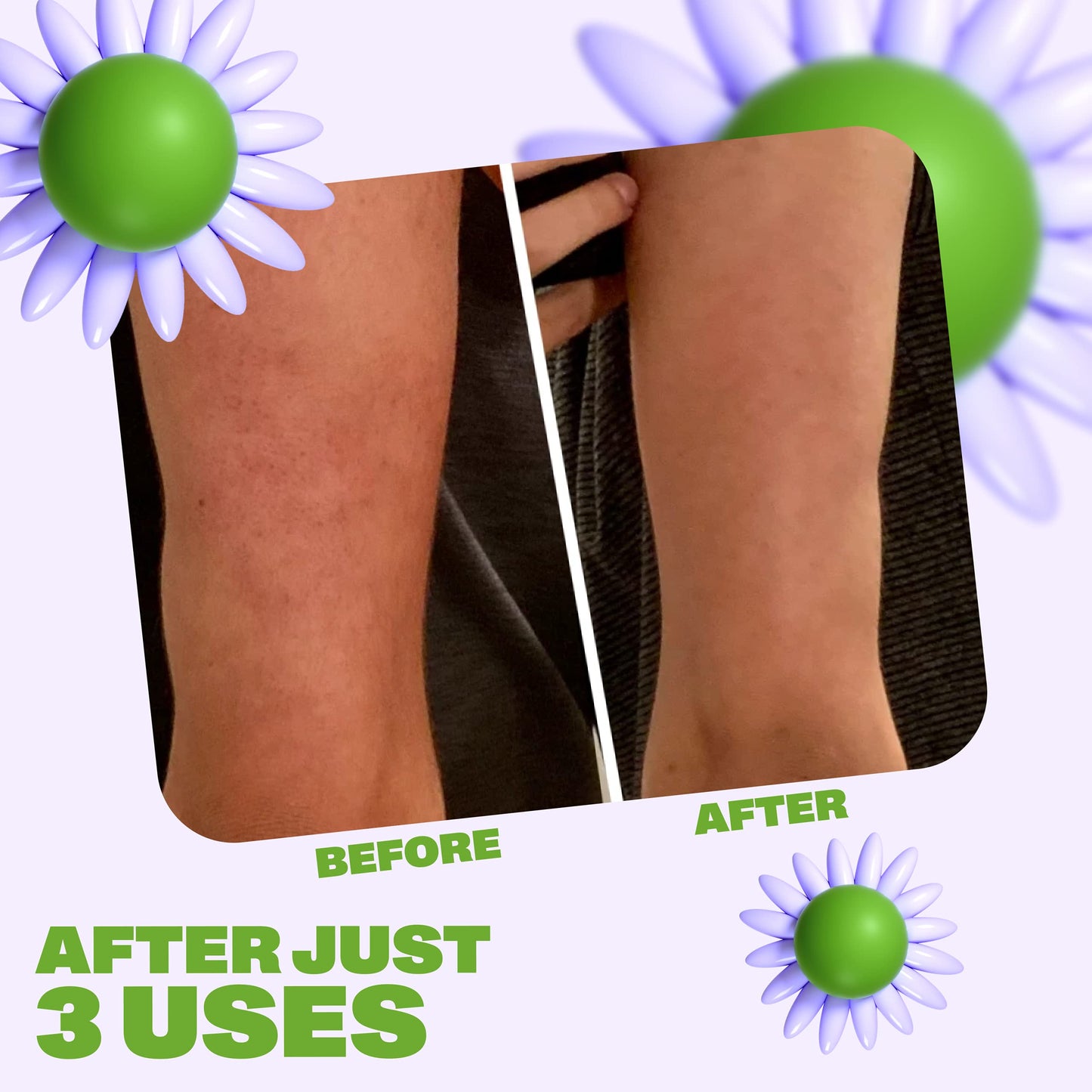 Becky | Natural Walnut Scrub + Exfoliator for Smooth Skin – Reduces Cellulite, Stretch Marks, Bikini Bumps, and Dry Skin | For Butt, Thighs, Legs, and Body