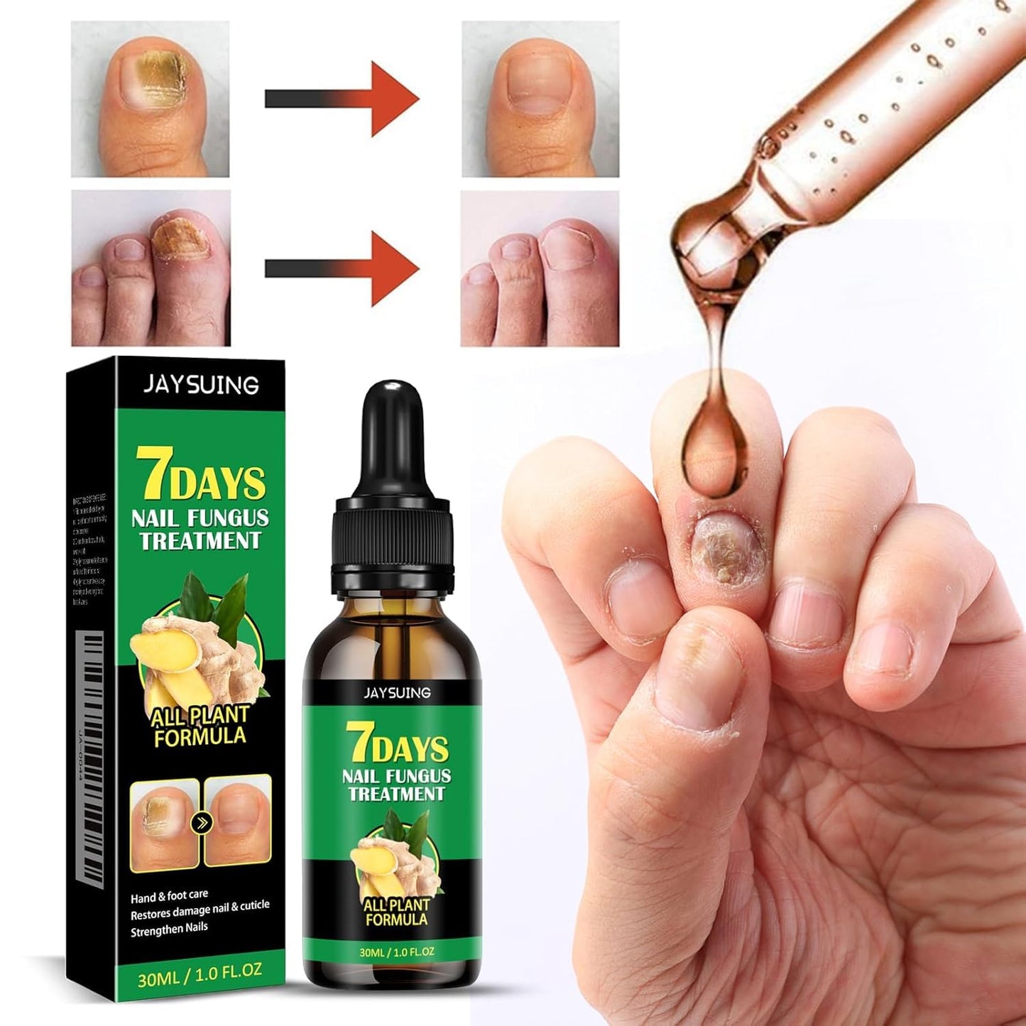 7 days Nail Treatment, Ginger Nail Treatment, Nail Nutrient Oil Strengthener Oil