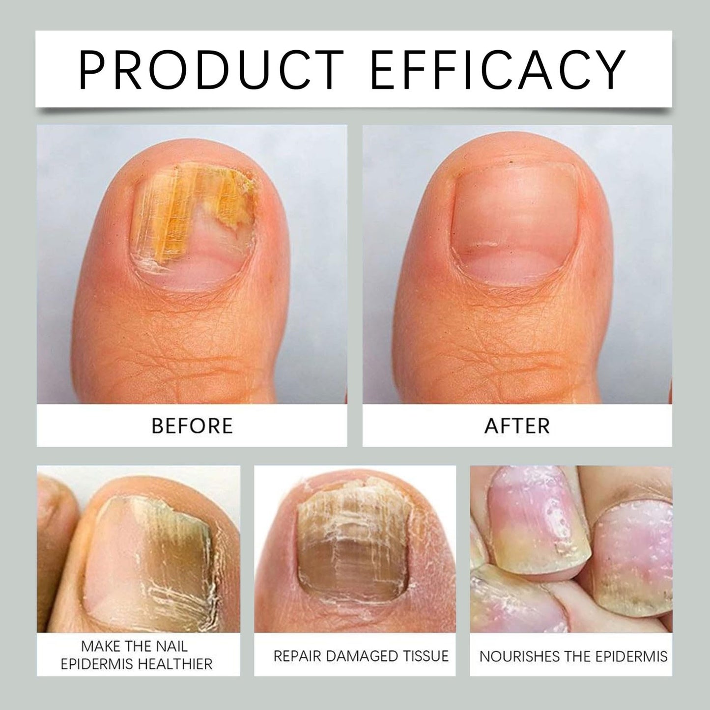 7 day Ginger Nail Care Spray Serum, Nail Oil for Growth and Strength Helps Nails Healthy Grow, Nail Care Spray Multi-Use Nail Nourishing Serum, Nail Growth Oil, 30ml (1 pcs)