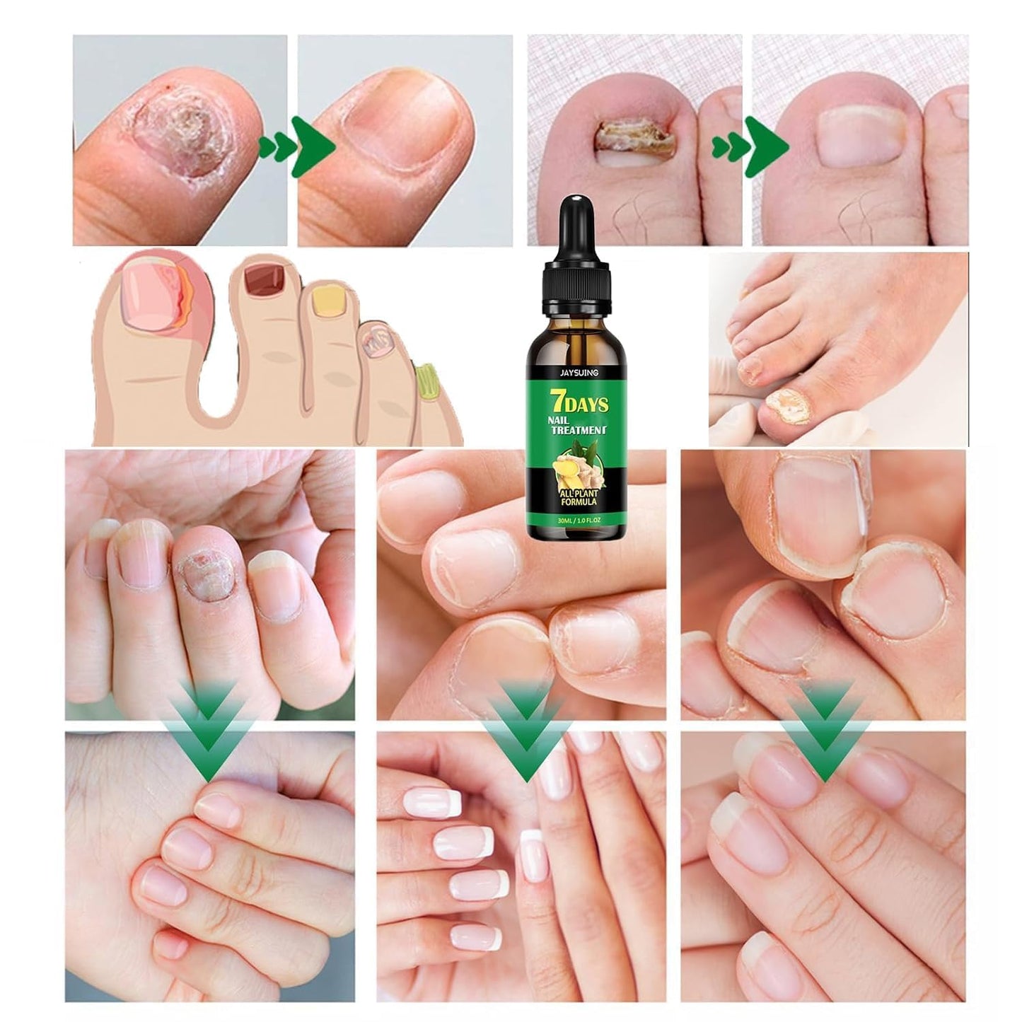 7 days Nail Treatment, Ginger Nail Treatment, Nail Nutrient Oil Strengthener Oil