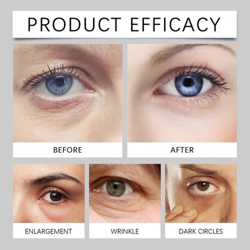 CUMABALM For Eye Bags, Under Eye Balm Stick for Under Eyes Bags, Turmeric Serum Cream Stick, Deep Moisturizing Hydrating (2)