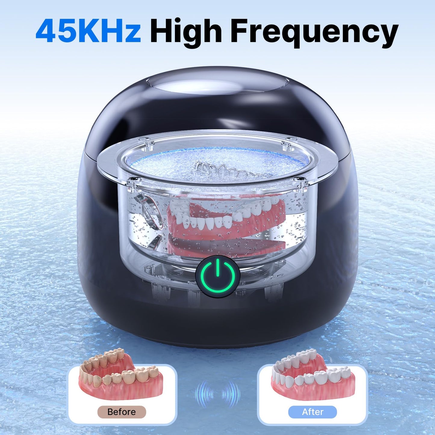 CXRUY Ultrasonic Retainer Cleaner - UV Dental Cleaning Pod Night Guard Cleaner for Dentures, Aligner, Braces, Toothbrush Heads, Jewelry (Black)