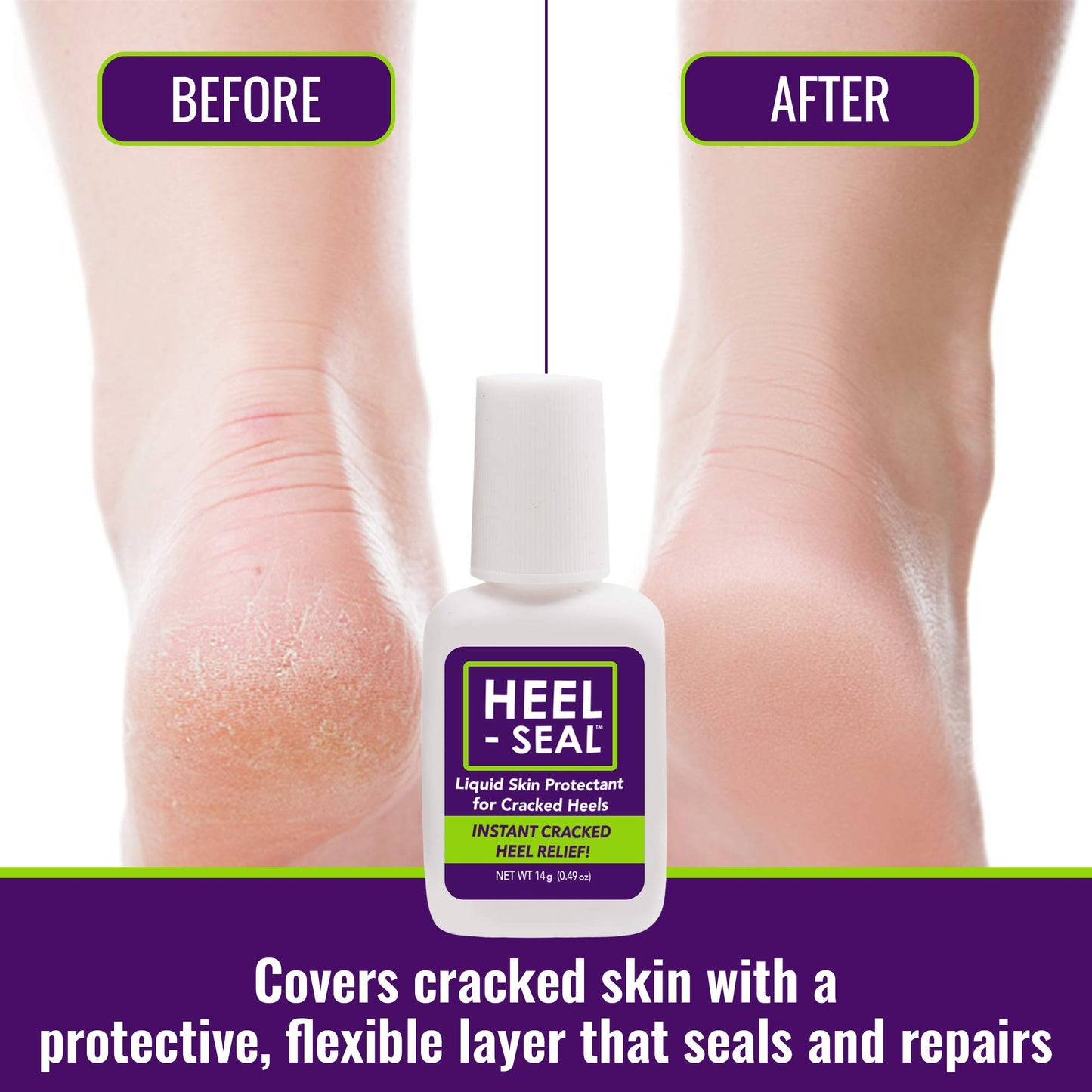 Heel-Seal - New Larger Size, 3X the Applications - The #1 Liquid Skin Protectant for Cracked Heels, Cracked Feet Treatment, Liquid Bandage, Must-Have Foot Care for Cracked Feet, Foot Repair