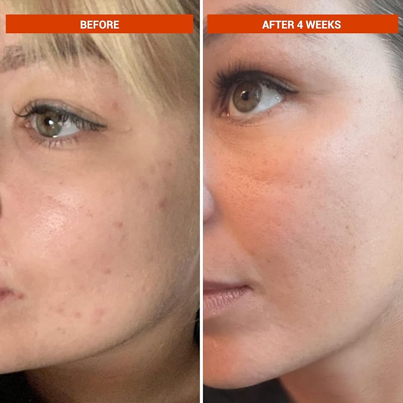 BeautyStat Universal C Serum 20% Pure Vitamin C with Hyaluronic Acid – 1.7 fl oz / 50 ml