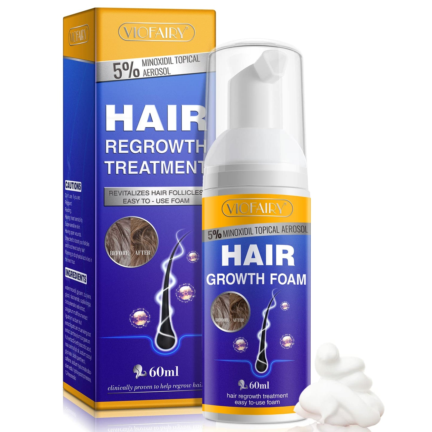 5% Minoxidil Foam for Hair Growth and Thickening - Biotin & Minoxidil Treatment to Stop Thinning & Hair Loss for Men & Women, 2oz