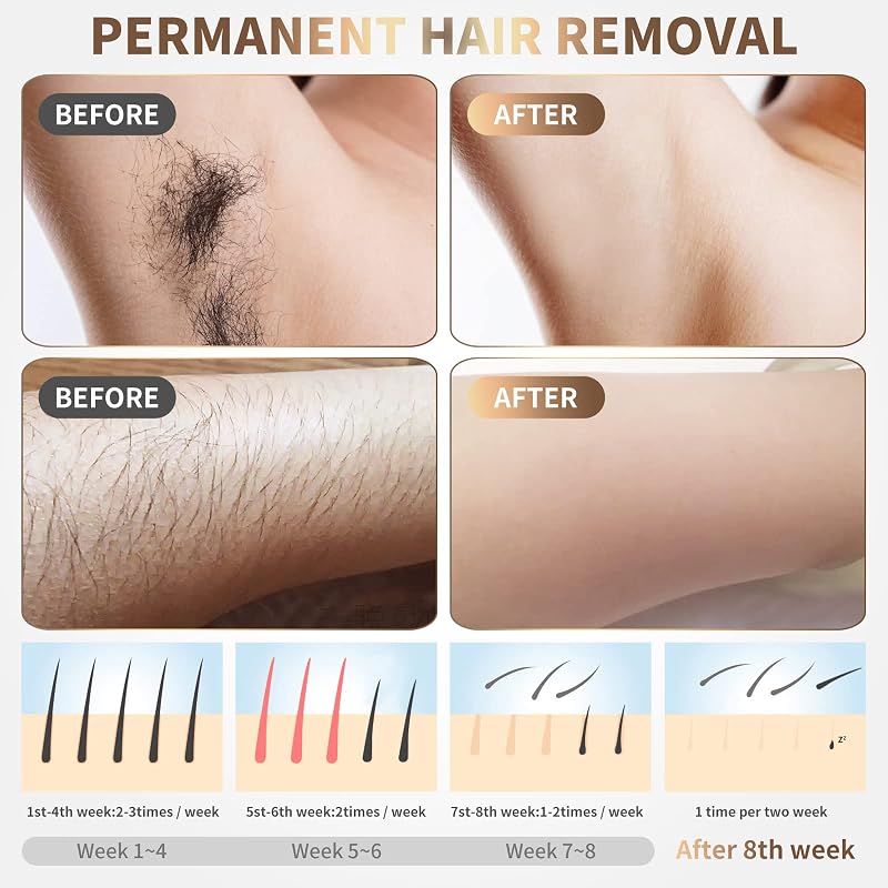 Gransumr White-Purple IPL Hair Removal Device for Home Use – 5 Energy Levels, 999,999 Flashes