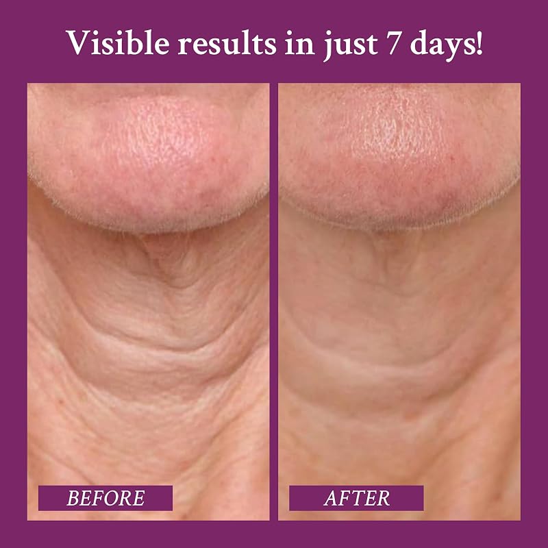 PRAI Ageless Neck Cream with Sepilift & Hyaluronic Acid 6.8 Oz