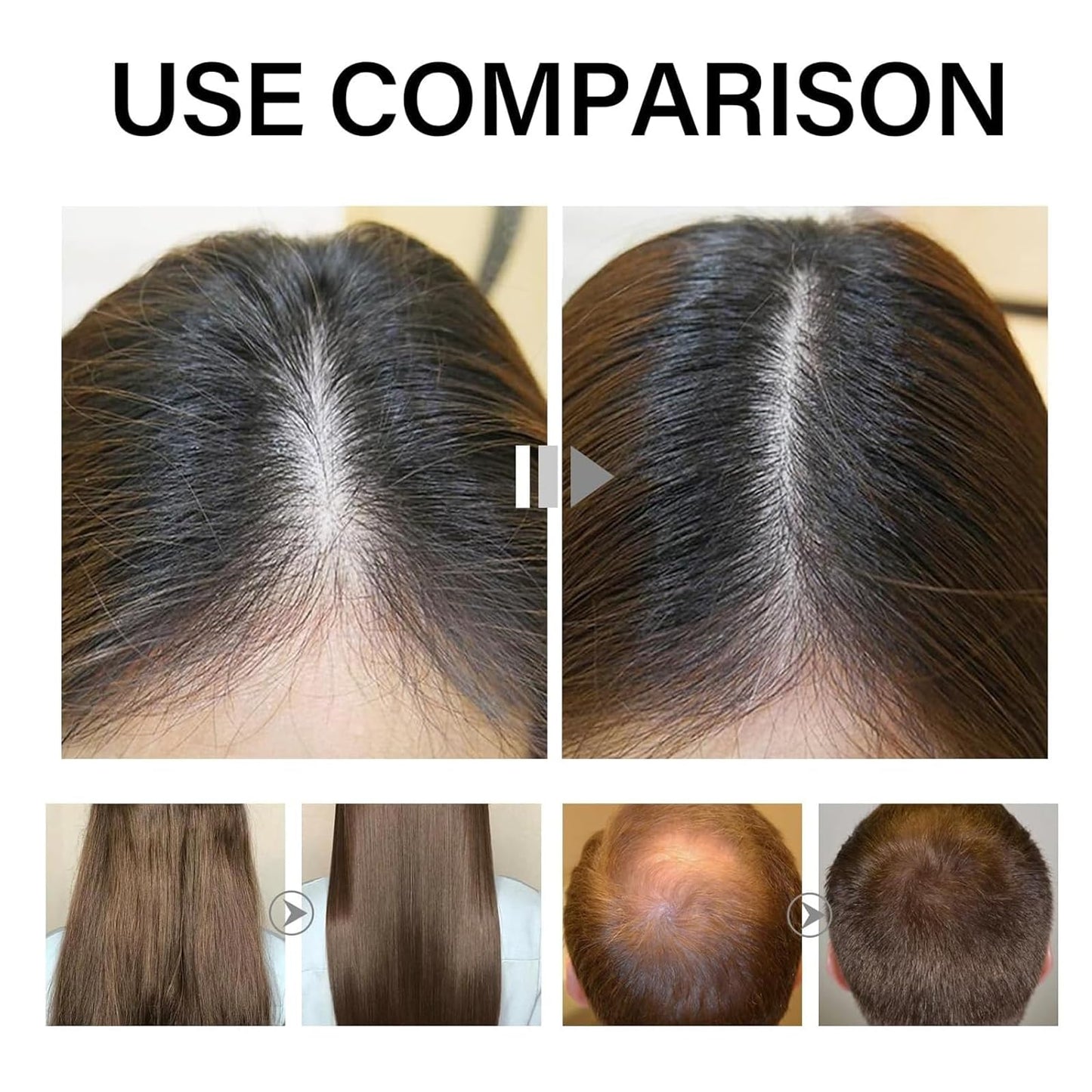 Deoxyribose Sugar Hair Growth Serum | Scalp Treatment for Thicker, Stronger Hair | Reduces Hair Loss | Nourishes with Green Tea & Ginseng Extract (1PCS)