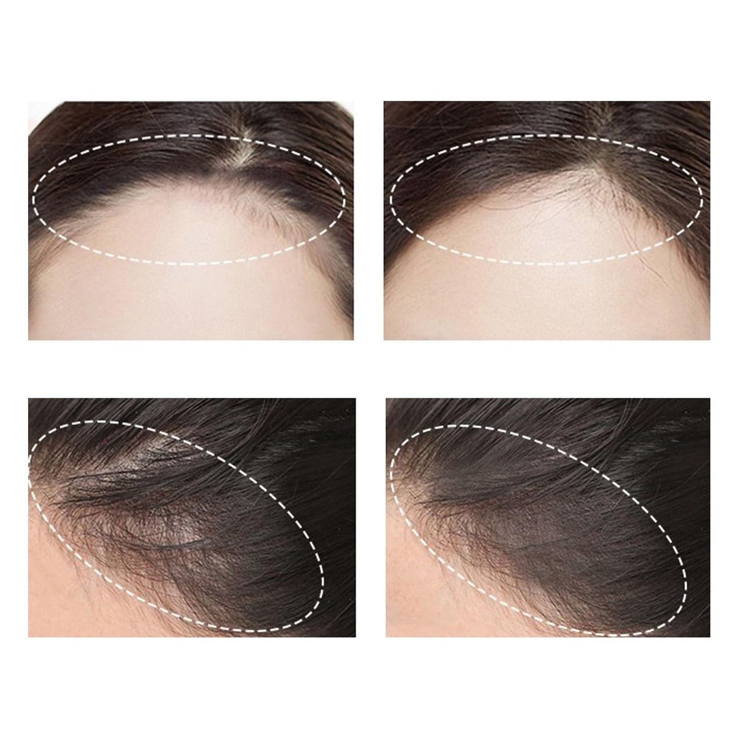 Nivaro Polvo Capilar, Nivaro Polvo, Nivaro Polvo Para El Cabello, Nivaro Polvo Densificador, Nivaro Polvo Densificador Instantáneo, Nivaro Polvo Capilar Para Hombre (1, 006)