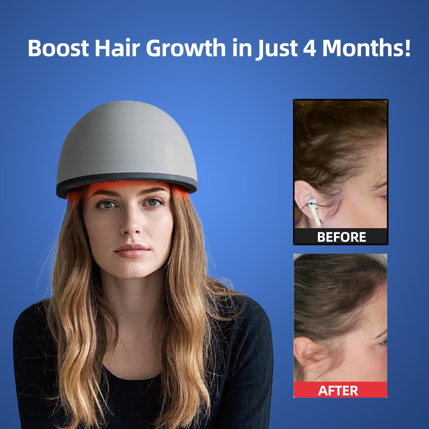 Hair Growth Device with Laser Red Light Therapy, FDA Cleared Hair Loss, Hair Thinning & Alopecia Treatment for Men & Women, Hair Regrowth Laser Cap