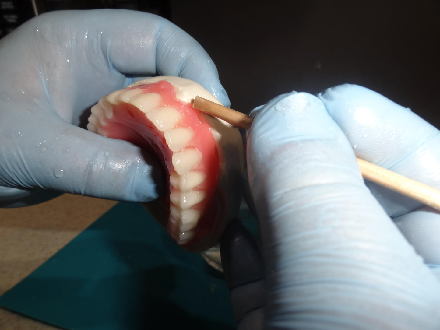 Jesse Dent - DIY Dentures, Customizable Kit with 12 Pieces, Simple to Use. Dentures Upper and Lower, Home Denture Solution for an Ideal Smile, Women and Men