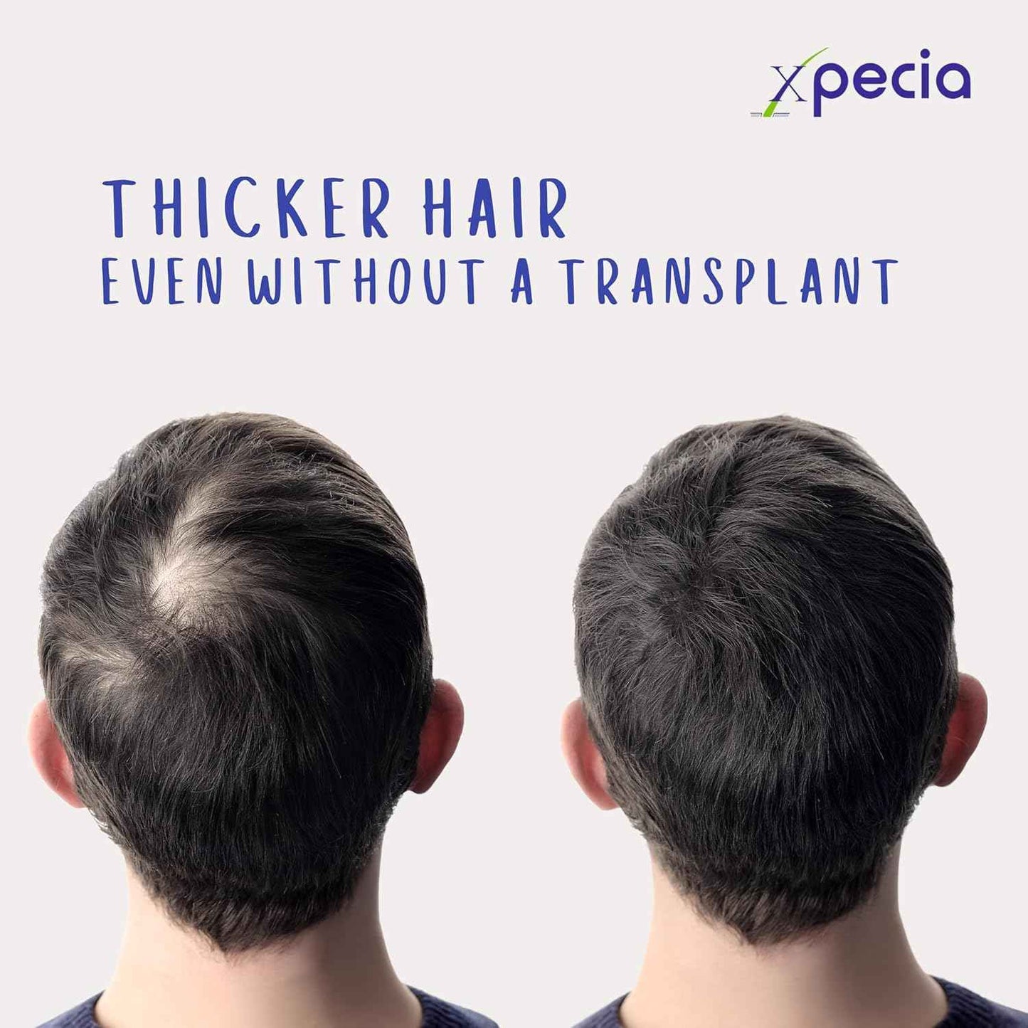 XPECIA FOR MEN ANTI HAIR LOSS DHT BLOCKER NEW HAIR GROWTH FORMULA 60 TABLETS