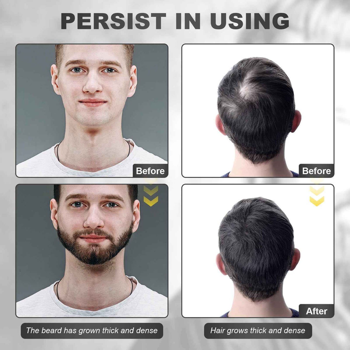 Beard Growth Kit - Beard Kit for Men with Beard Growth Oil (2oz), Beard Balm, Beard Comb, Massager for Spot/Patchy Beard - Christmas, Anniversary, Birthday for Men, Dad, Husband, Boyfriend