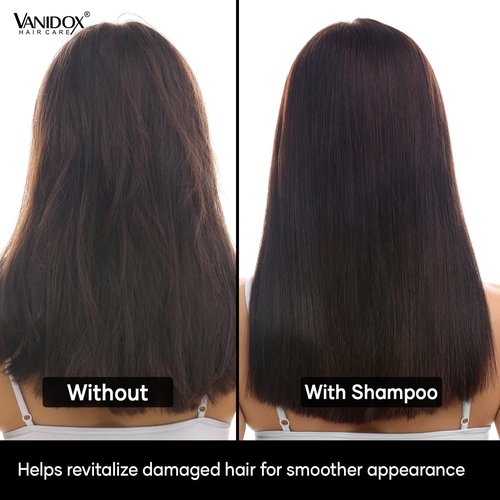 VANIDOX ReFortix Korean Shampoo and Conditioner Set, Enriched with Ginseng, Green Tea, and Camellia Oil, Supports Growth Stage and Helps Reduce Hair Loss for Stronger Hair (16 fl oz each)