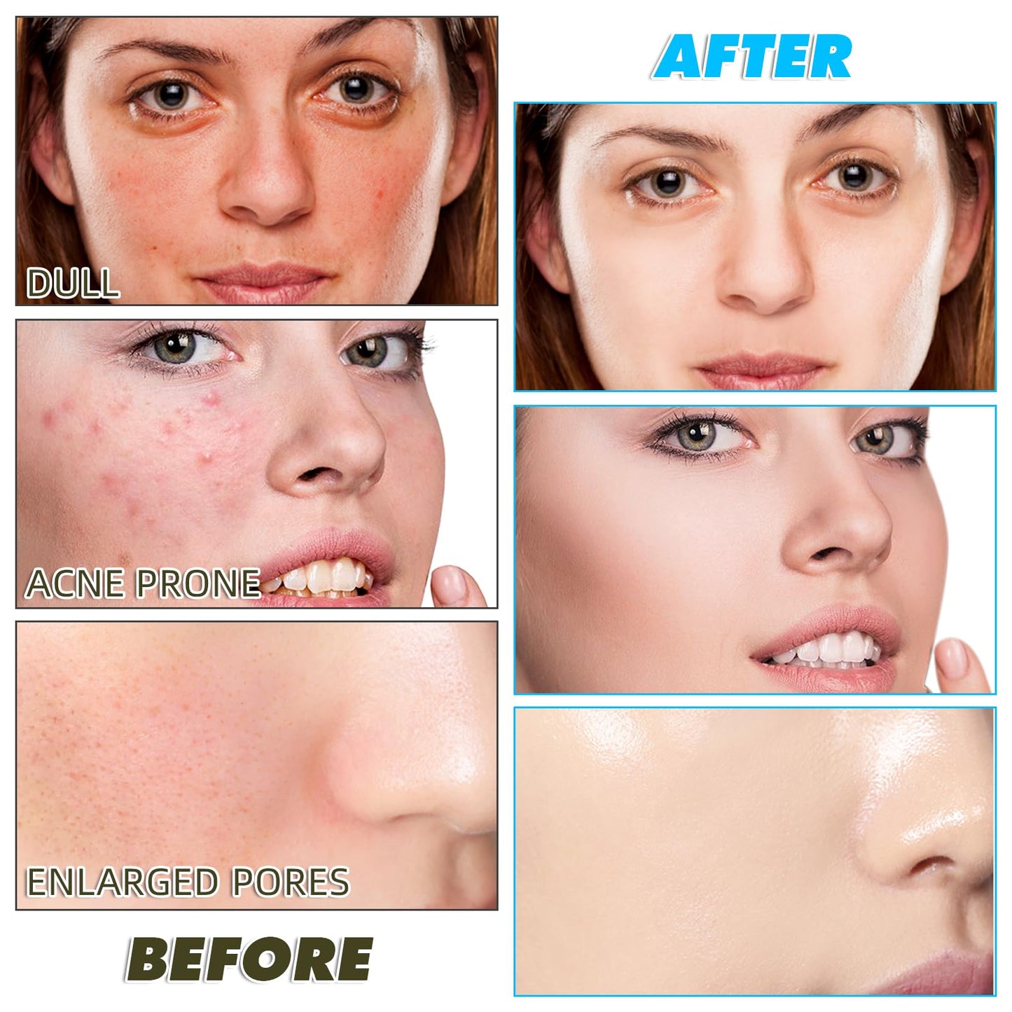 Kojic Acid Turmeric Cleansing Pads, Face Turmeric & Kojic Acid Pads for Dark Spots, Glow Up Acne Scars, Unclog Pores, Enriched Vitamin C,Gentle & Non-Irritating