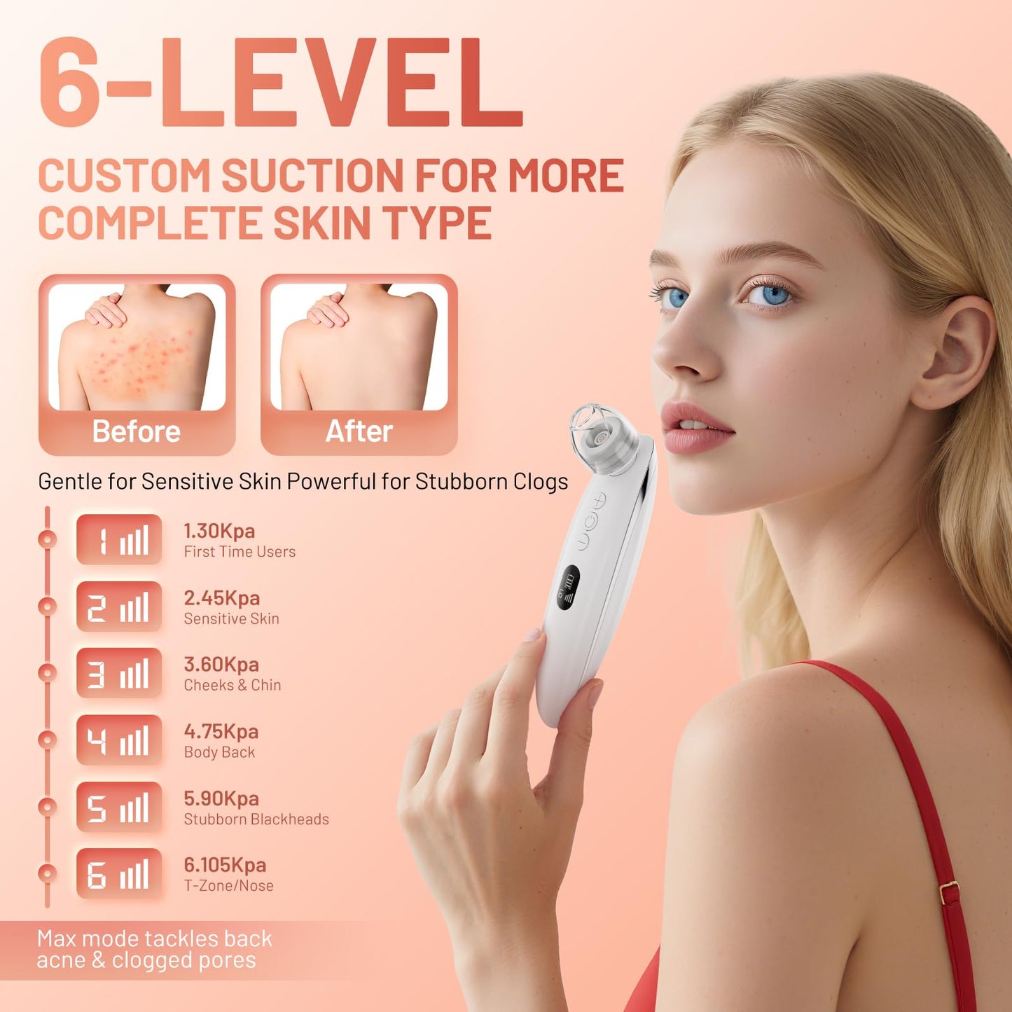Blackhead Remover Vacuum Pore Extractor for Face Scraper Facial Pore Vacuum Cleansing Tool Sucker Kit for Men Women USB 4 Suction Heads, 6 Adjustable Modes (Pure White)