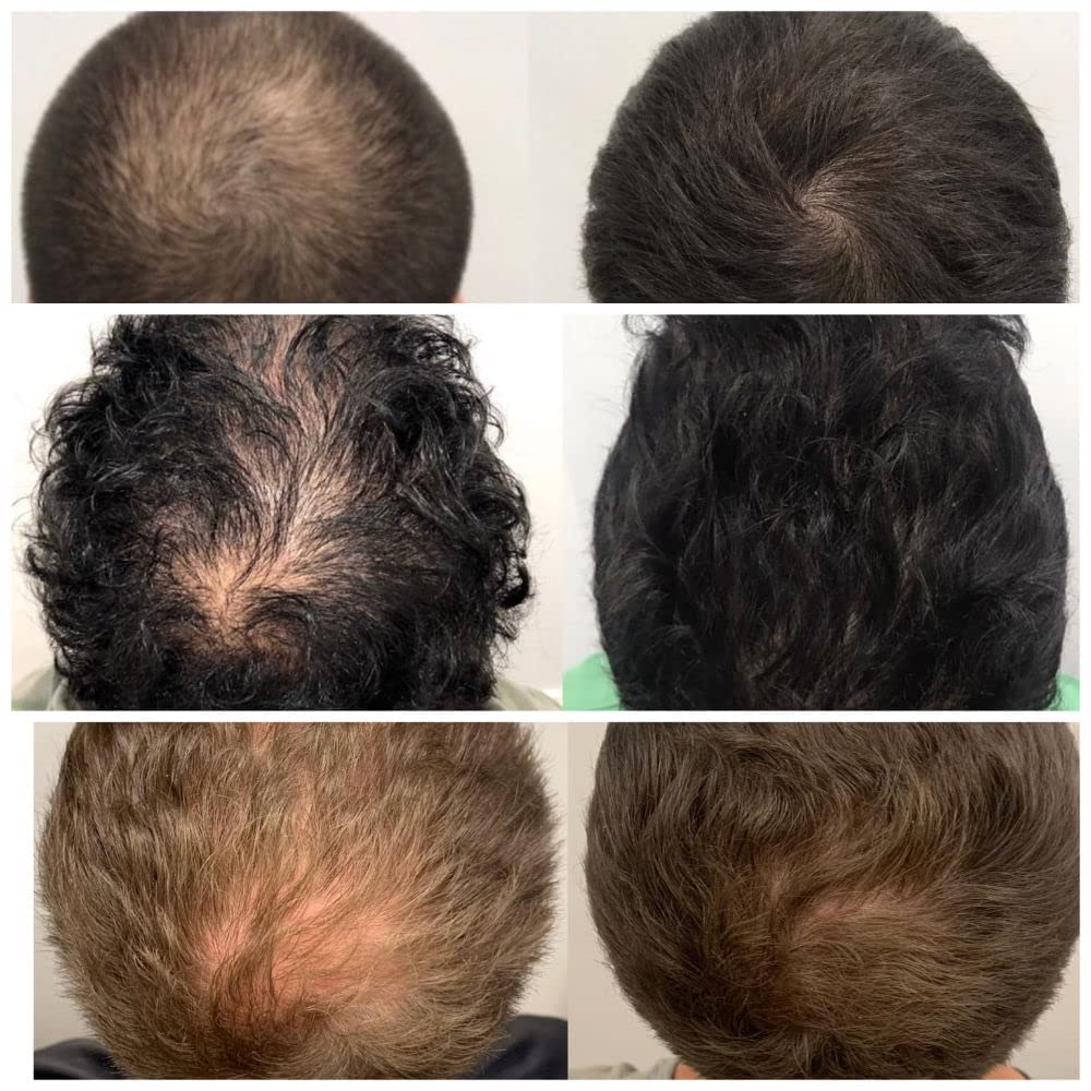 Magic Hair Growth Tonic with Ginseng – 60ML Hair Loss Treatment for Men & Women, Fast Hair Regrowth Serum for Thicker, Fuller Hair