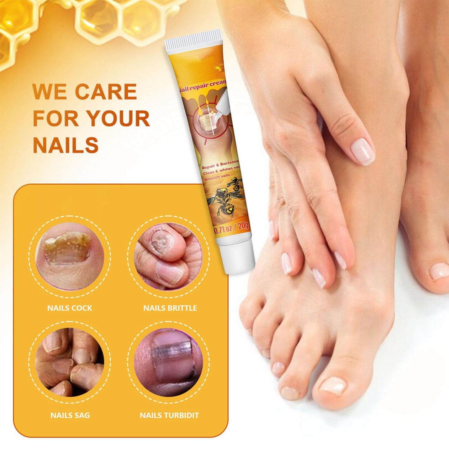 Bee Venom Nail Repair Cream, Whitening and Smoothing Treatment, Repairs Damaged Nails, Strengthens Nails, Promotes Nail Health, Nourishes and Moisturizes