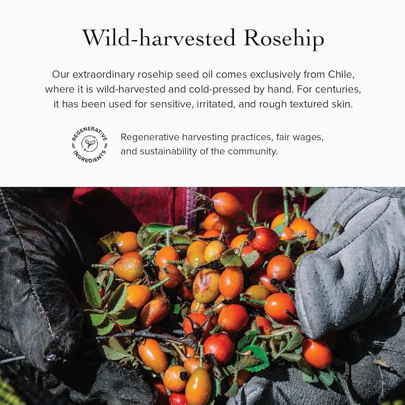 Rosehip Calming Serum Facial Oil for Sensitive Skin