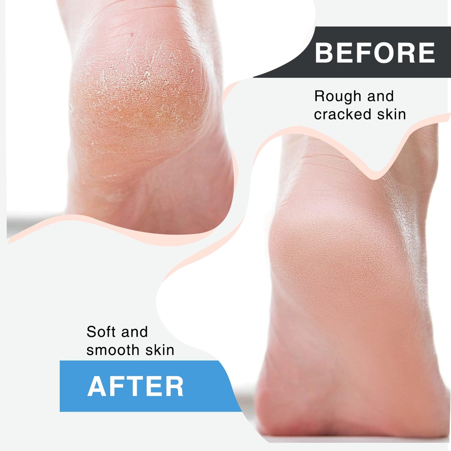 Qiyuda 3 Pcs 4 in 1 Foot Brush, Shower Foot Cleaning Scrubber Pedicure Brush Dead Skin Remover