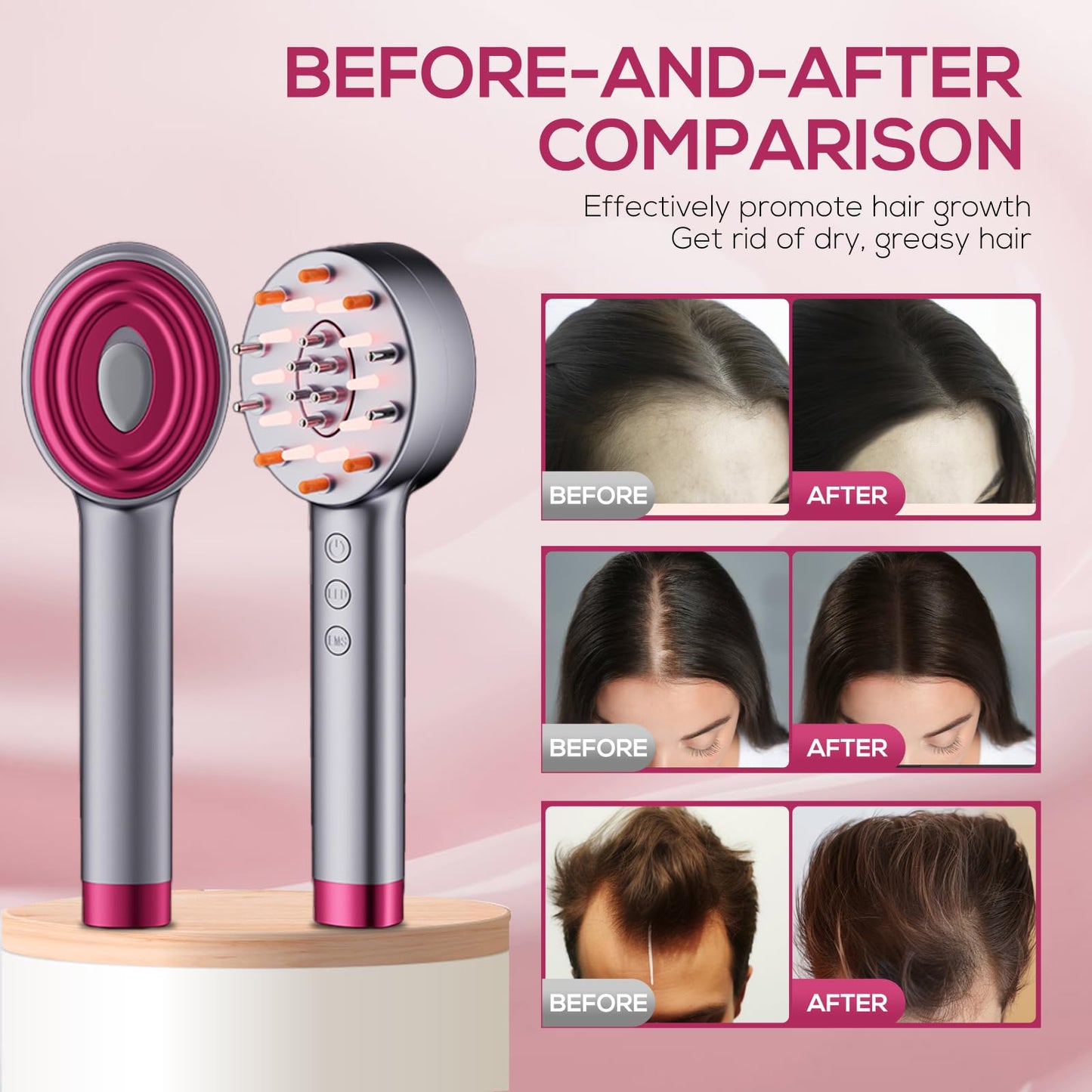 Laser Hair Growth Comb, Laser Comb Laser Hair Growth Device Electric Scalp Massager for Hair Growth,Stimulates Hair Growth Comb Brush Thinning Hair Treatment Laser Therapy Comb