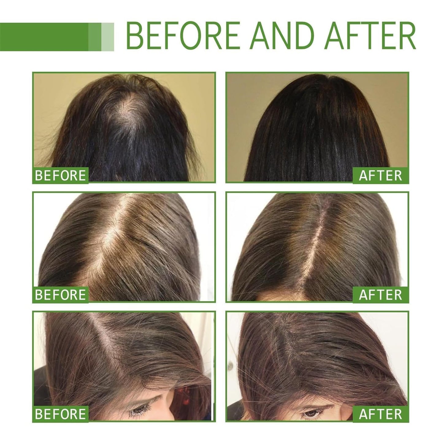 Deoxyribose Sugar Gel Hair Growth, 60ml Deoxyriboes Hair Growth Serum Suitable for All Hair Types (2bottle)